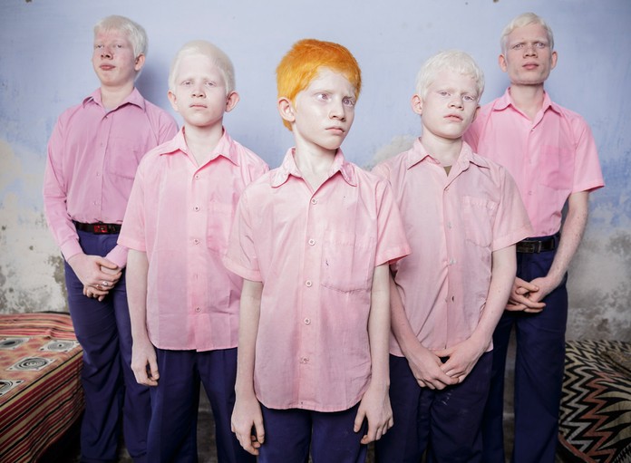 Rapazes albinos cegos numa escola, Índia
